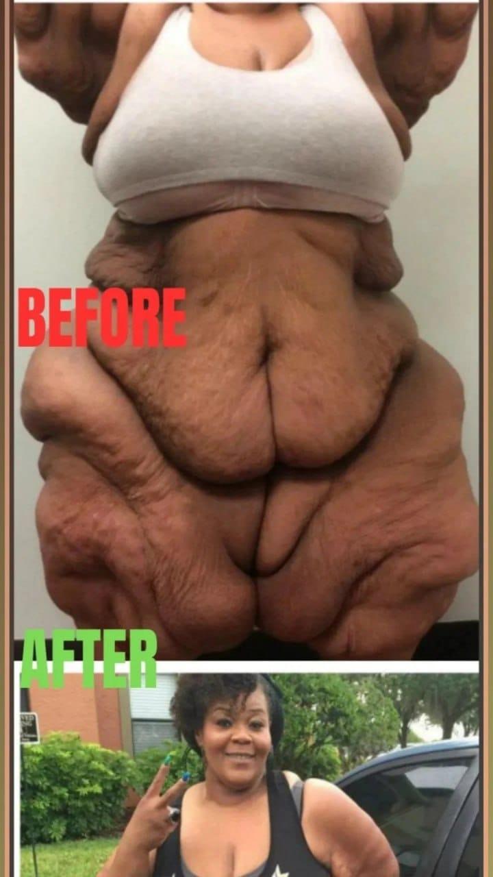 World’s heaviest woman who weighed 50 stone now unrecognisable