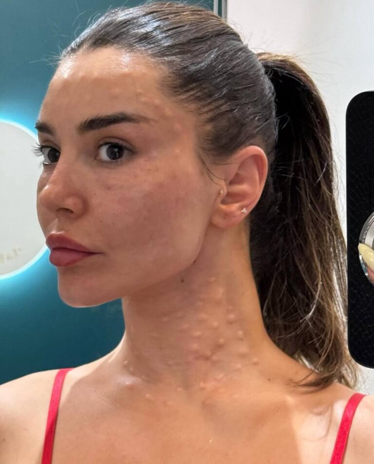 Her body was itchy, he thought it was an allergy