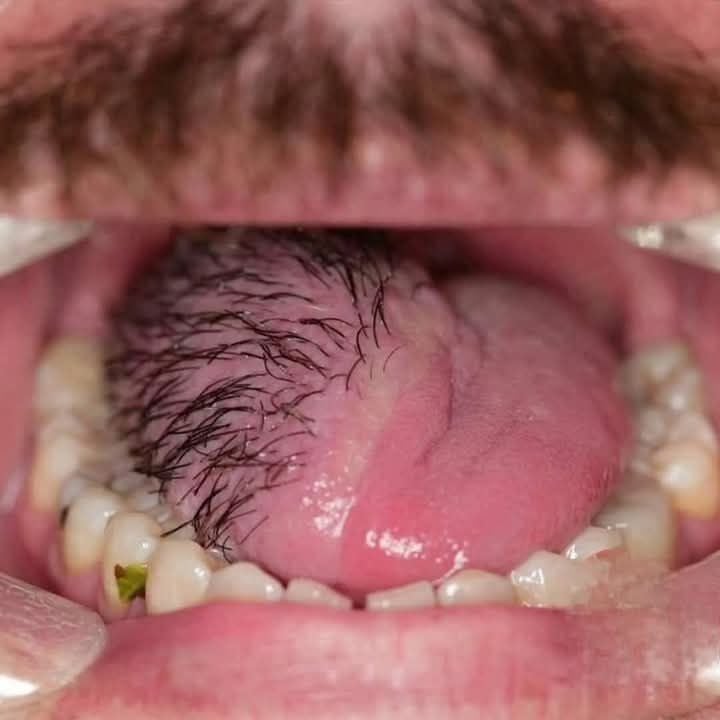 These are the consequences of sleeping with the…See more